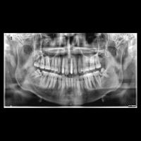 Radiografias Clínicas project thumbnail