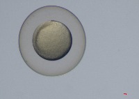 dre-embryo project thumbnail