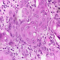 MitosisDetection project thumbnail