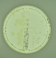 bacteria project thumbnail