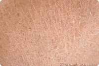skin type detection project thumbnail