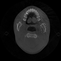 dentist project thumbnail
