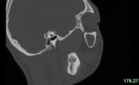 PG4-WangZe\Sagittal159 project thumbnail