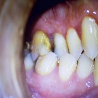 dental_project project thumbnail
