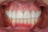 Label Dentes project thumbnail