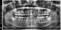 Object Reg project thumbnail