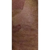 Skin Diseases project thumbnail