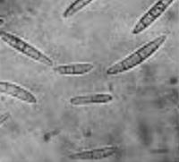 Fusarium project thumbnail