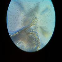Fungi Detection project thumbnail