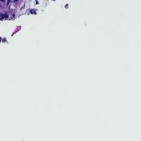 cell bb project thumbnail