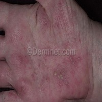 Derma Net project thumbnail
