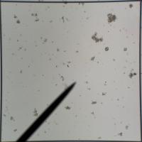 Find diatom frustules, amorphous debrises and strands of cyanobacteria project thumbnail