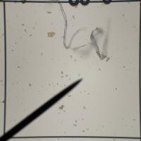 Find cyanobacteria strands, diatom frustules and amorphous debrises project thumbnail
