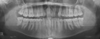 Smart Dental OPG Analyzer project thumbnail