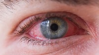 image classification project thumbnail