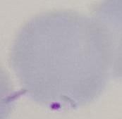 CellDetection project thumbnail
