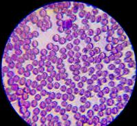 platelet project thumbnail