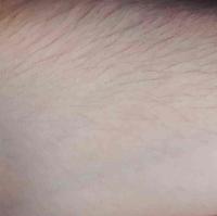 Skin Disease Detection project thumbnail