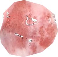 SEG via classify project thumbnail