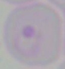 malaria_C project thumbnail