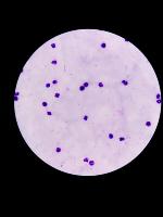 plasmodium malaria project thumbnail