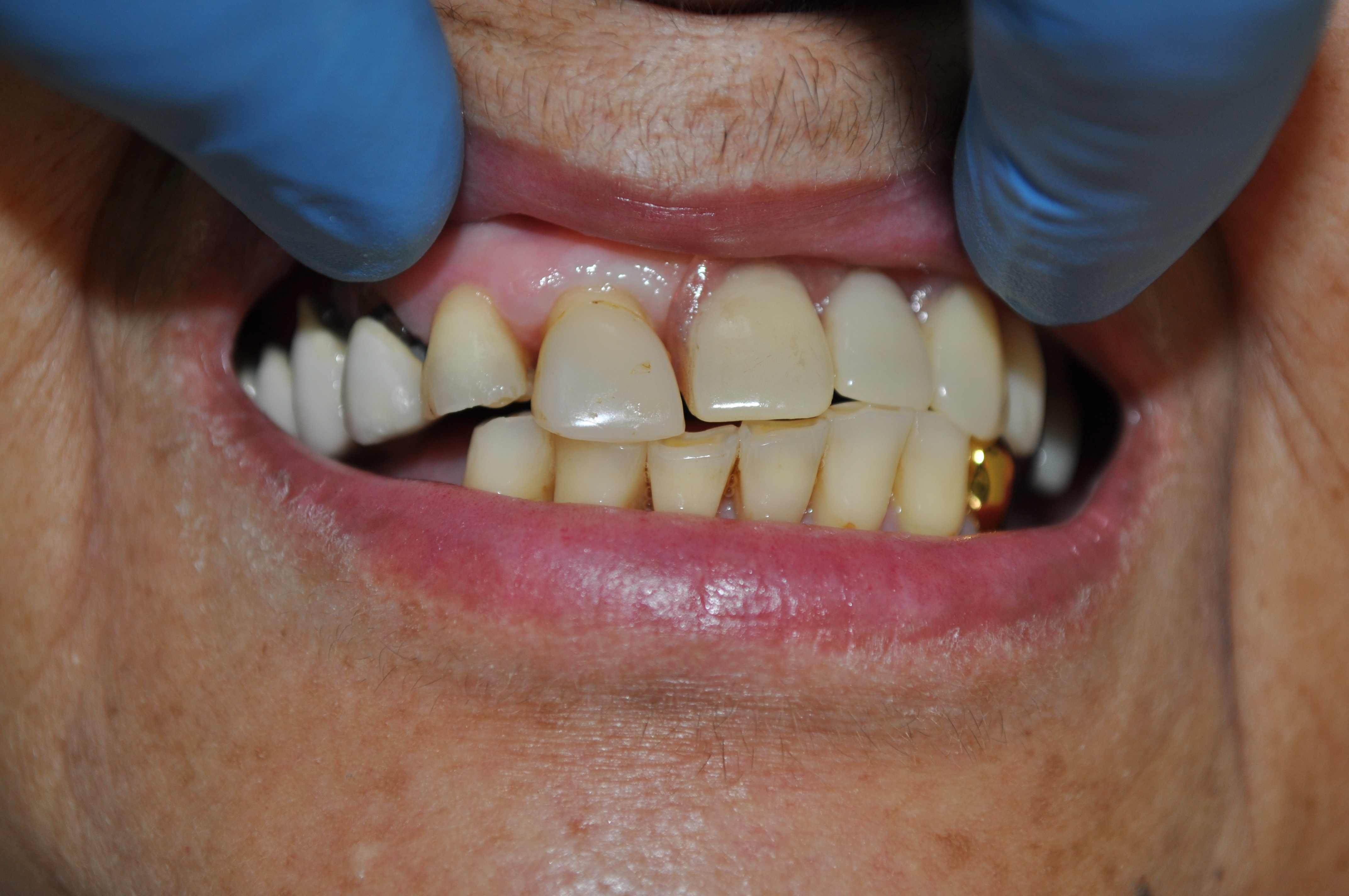 tooth_segment Instance Segmentation Dataset by Tooth