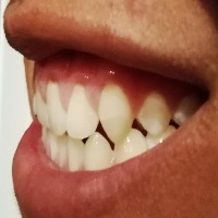 smile project thumbnail