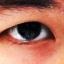 Eyes project thumbnail
