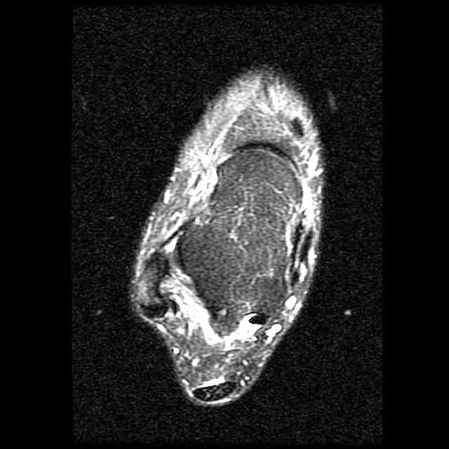 s-m-to-yolov8-preprocess-object-detection-dataset-by-biodata