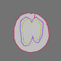 Annotation Visualization