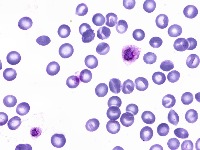 Malaria-Prueba project thumbnail