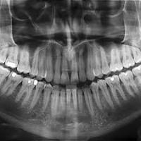 Find teeth 2 project thumbnail