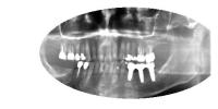 xraytoothstatus project thumbnail