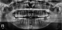 DentalPanorama project thumbnail