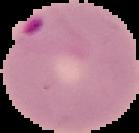 Cell infection detection project thumbnail