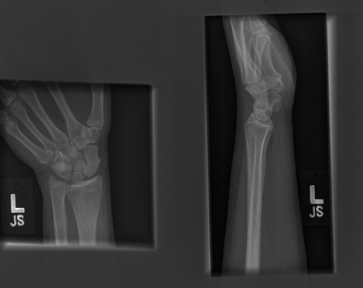 MURA Object Detection Dataset by techspace