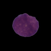 Leukemia-dataset project thumbnail