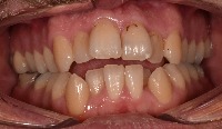 Anterior Dental Anatomy project thumbnail