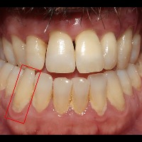 Anterior Dental Anatomy project thumbnail