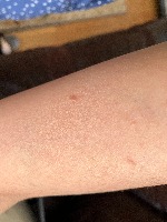 lesions project thumbnail