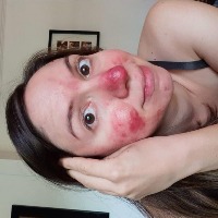 Skin Issues project thumbnail