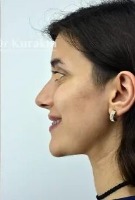 Face profile project thumbnail