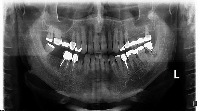 Tooth instance segmentation project thumbnail