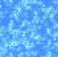 globules_roi project thumbnail