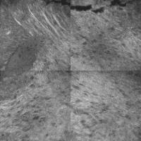gbm_7.1_microtumor_xy project thumbnail