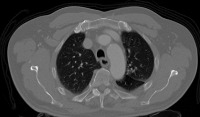 Ct scan project thumbnail