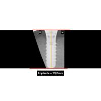 My First Project project thumbnail
