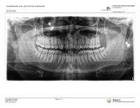 Impacted Teeth project thumbnail
