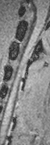 Lesion Segmentation Instance Segmentation Dataset by Test