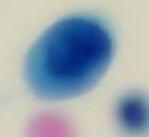 HSIL project thumbnail
